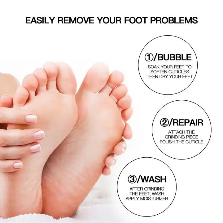 NNEDSZ Gray Electric Foot Callus Remover - Portable Pedicure Tool for Smooth Feet